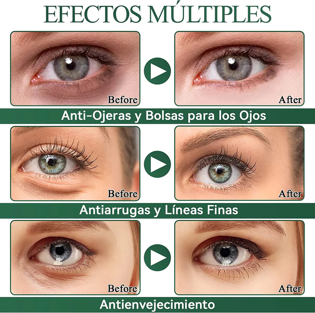 Parches de Ojos Anti-Aging con Ácido Hialurónico